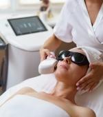 Laser epilazione progressivamente definitiva - Viso (Donna)