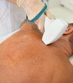 Laser epilazione progressivamente definitiva - Schiena - Uomo